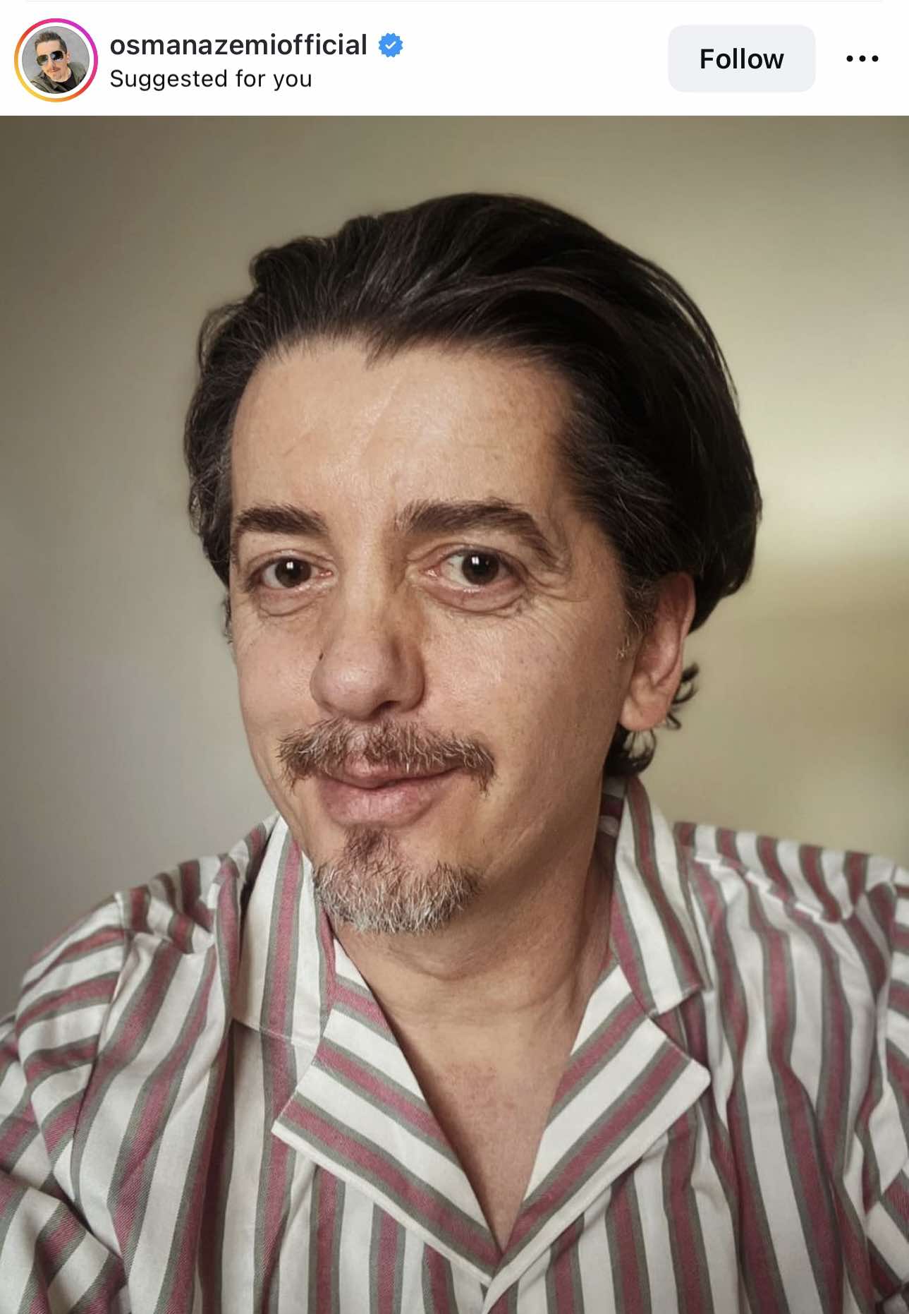 Kështu po duket Osman Azemi pas aksidentit, paska ndryshuar shumë